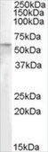 Anti-PNPLA2/ATGL antibody produced in goat affinity isolated antibody, buffered aqueous solution