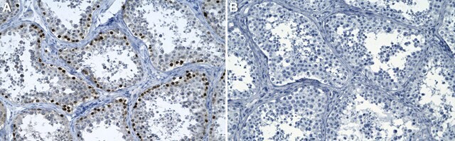 Anti-TRF1/TERF1 Antibody, clone 6I14 ZooMAb&#174; Rabbit Monoclonal recombinant, expressed in HEK 293 cells