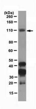 Anti-Dnmt3b Antibody, clone D3B2-2C1 clone D3B2-2C1, from rat