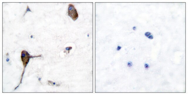 Anti-IL-3R &#946; antibody produced in rabbit affinity isolated antibody