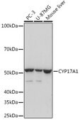 Anti-CYP17A1 Antibody, clone 5D2H1, Rabbit Monoclonal