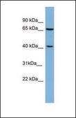 Anti-POLB antibody produced in rabbit affinity isolated antibody