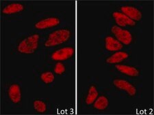 Rabbit anti-BRD2 Antibody, Affinity Purified Powered by Bethyl Laboratories, Inc.