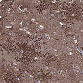 Anti-SLC1A2 antibody produced in rabbit Prestige Antibodies&#174; Powered by Atlas Antibodies, affinity isolated antibody, buffered aqueous glycerol solution