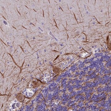 Anti-SKIDA1 antibody produced in rabbit Prestige Antibodies&#174; Powered by Atlas Antibodies, affinity isolated antibody, buffered aqueous glycerol solution