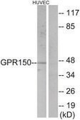 Anti-GPR150 antibody produced in rabbit affinity isolated antibody