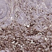 Anti-LUM antibody produced in rabbit Prestige Antibodies&#174; Powered by Atlas Antibodies, affinity isolated antibody, buffered aqueous glycerol solution