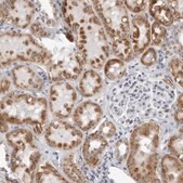 Anti-CPT2 antibody produced in rabbit Prestige Antibodies&#174; Powered by Atlas Antibodies, affinity isolated antibody, buffered aqueous glycerol solution, ab3