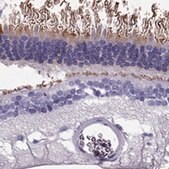 Anti-PDE6A antibody produced in rabbit Prestige Antibodies&#174; Powered by Atlas Antibodies, affinity isolated antibody, buffered aqueous glycerol solution