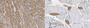 Anti-Myosin 7 (MYH7) Antibody, clone 4B51E8 clone 4B51E8, from rat