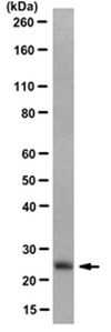 Anti-Transgelin/SM22a Antibody, clone 20F2.2 clone 20F2.2, from mouse