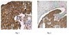 Anti-Metadherin Antibody, clone 2F11C3 clone 2F11C3, from mouse, purified by affinity chromatography