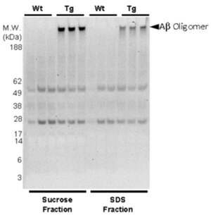 Anti-phospho-Amyloid beta (Ser8) Antibody, clone 1E4E11 clone 1E4E11, from mouse