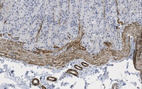 Anti-Sodium-Iodide Symporter Antibody, clone ARN1 clone ARN1, from mouse