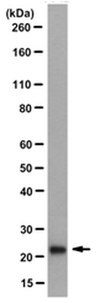 Anti-Transgelin/SM22a Antibody, clone 20F2.2 clone 20F2.2, from mouse