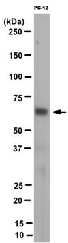 Anti-IMPDH1 Antibody, clone 4F9.1 clone 4F9.1, from mouse
