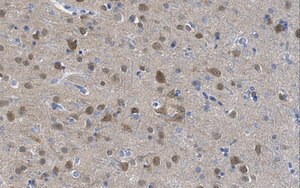 Anti-nonphospho-GSK3 (Ser9) Antibody, beta specific Antibody, clone 12B2 clone 12B2, from mouse