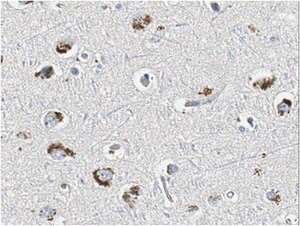 Anti- GABAA Antibody &#947;2 Subunit, clone KC4-8A7 clone KC4-8A7, from mouse