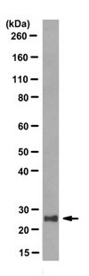Anti-Connexin-26 Antibody, clone 3B12.1 clone 3B12.1, from mouse
