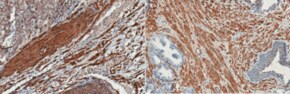 Anti-Calponin Antibody, clone CALP from mouse, clone N3/16, clone CALP