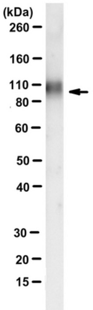 Anti-Autotaxin (ENPP2) Antibody, clone 7A5 clone 7A5, from mouse