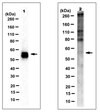 Anti-CYP11B1 Antibody, clone 80-7 clone 80-7, from rat