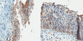 Anti-TRAP-1 Antibody, clone TR-1 clone TR-1, from mouse